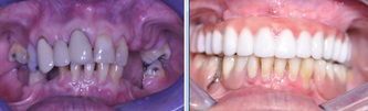 Gallery & Testimonials - DENTOLOGY | Smile Makeover | Dental Implants ...