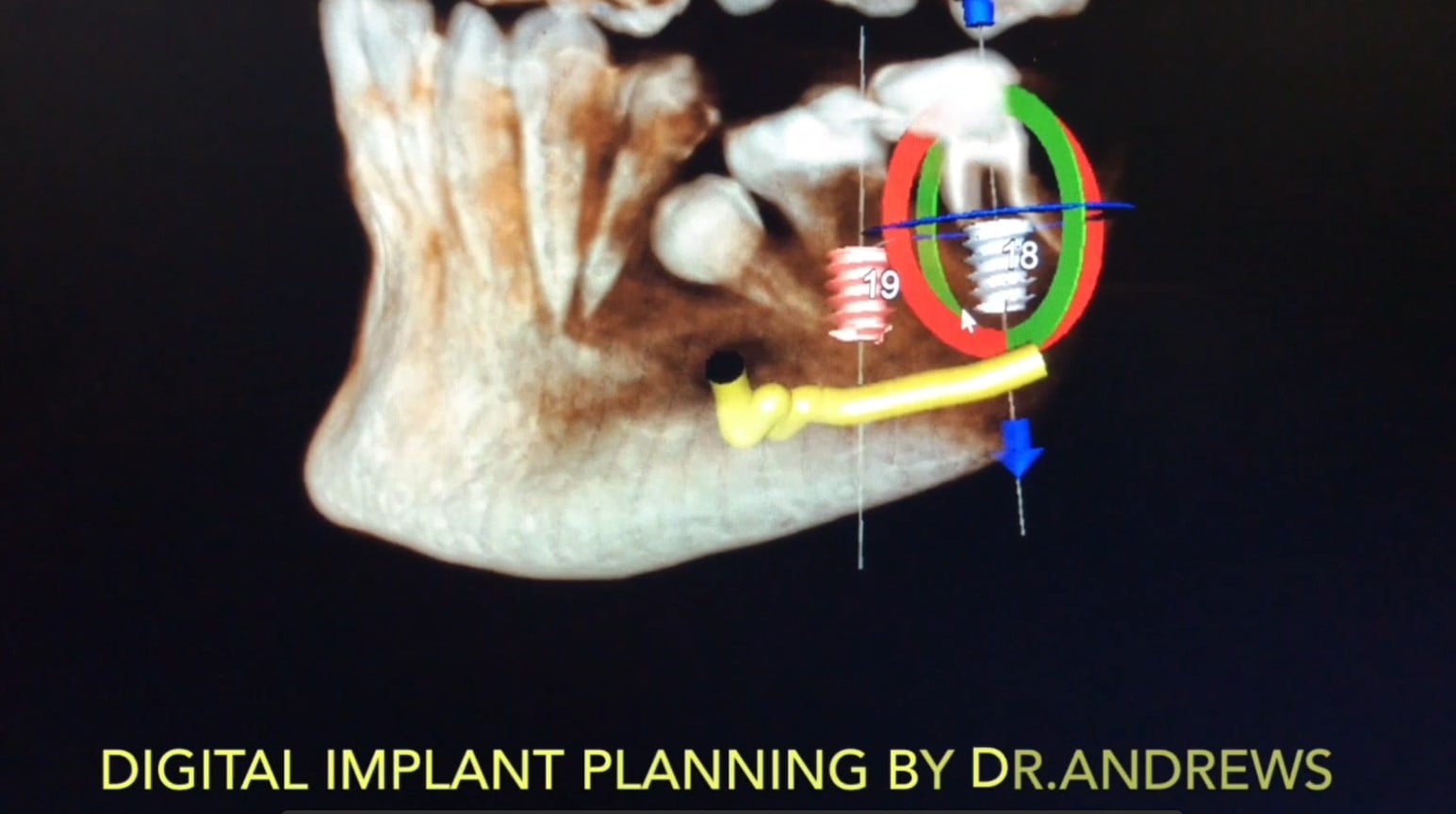 Digital dental planning and diagnostic imaging at DENTOLOGY